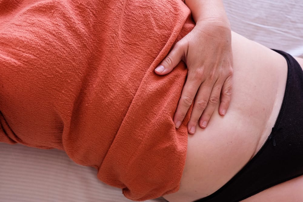 The Risk of Hernia After C-Section and How to Prevent It