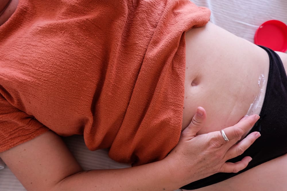 How to keep a C-Section Incision dry when Overweight